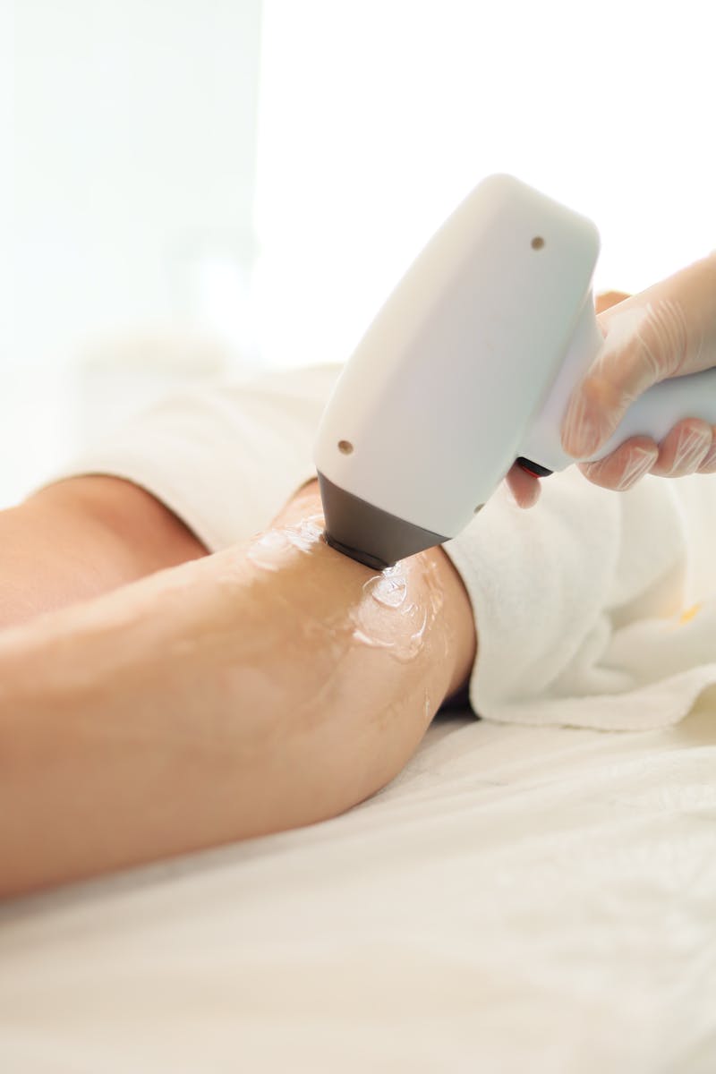 Close-up of laser hair removal being performed on an arm in a spa setting.